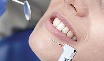 Dental Implants, Norwalk, CT